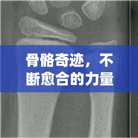 骨骼奇迹，不断愈合的力量与恢复之魅力